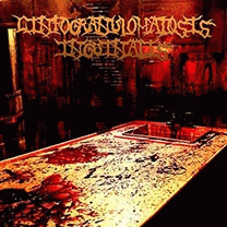 Linfogranulomatosis Inguinalis : Linfogranulomatosis Inguinalis Linfogranulomatosis Inguinalis : Linfogranulomatosis Inguinalis